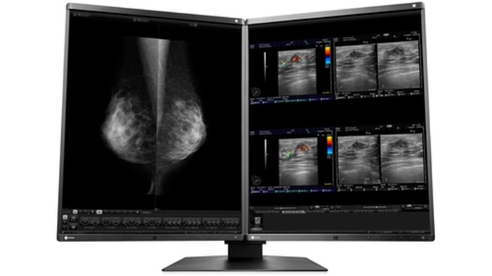Bild på EIZO MATCHED FOR MAMMODUO SOLUTION RX560-MD