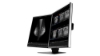 Bild på EIZO MATCHED FOR MAMMODUO SOLUTION RX560-MD