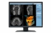Bild på EIZO 2MP EIZO RADIFORCE MX217-SB
