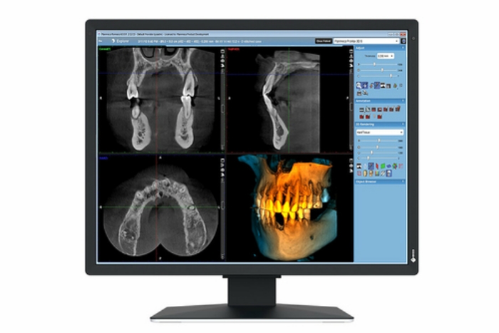 Bild på EIZO 2MP EIZO RADIFORCE MX217-SB