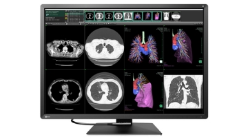 Bild på EIZO 12MP EIZO RADIFORCE RX1270