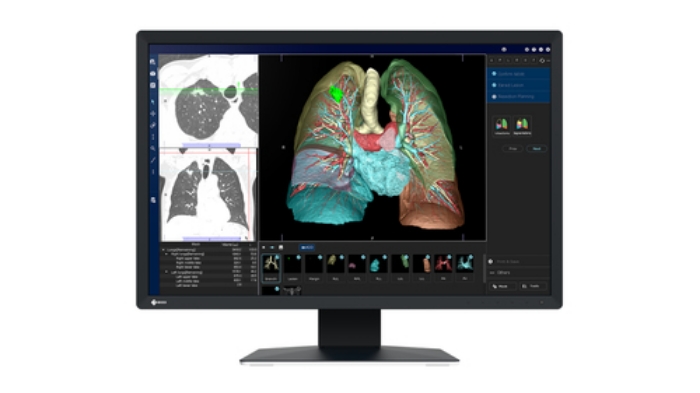 Bild på EIZO 2.3MP EIZO RADIFORCE MX243W