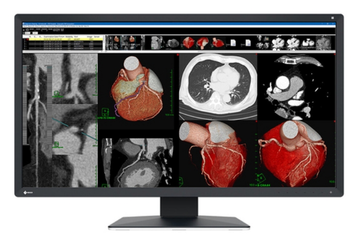 Bild på EIZO 8MP EIZO RADIFORCE MX317W 31IN