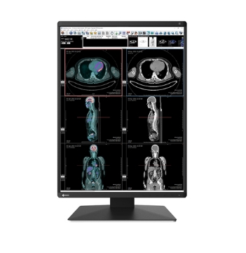 Bild på EIZO 3MP COLOR 21.3 EIZO RADIFORCE RX370