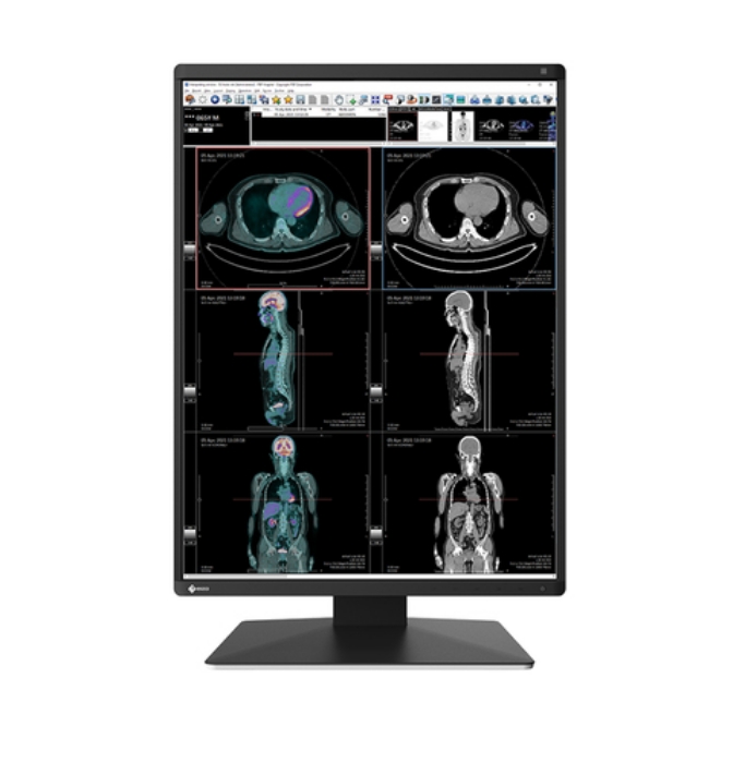 Bild på EIZO 3MP COLOR 21.3 EIZO RADIFORCE RX370